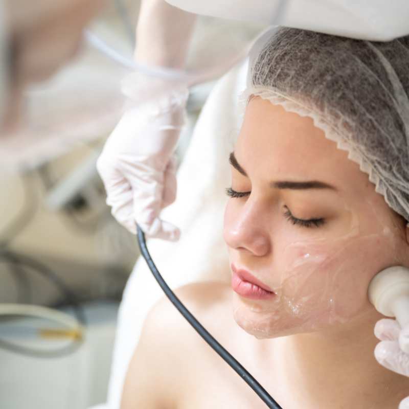 Why Do People Choose HIFU for a Non-Surgical Facelift? 5 What are the risks Leighton Buzzard?